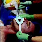 Airway Management